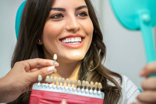 Young woman with perfect teeth , looking how white are her teeth , with teeth shade