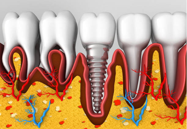 Dental implement. 3d render