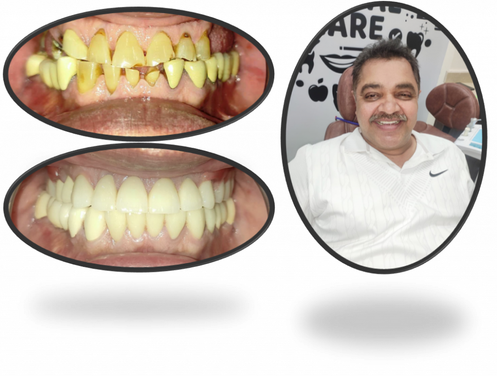 Patient Gallery Dental Designs
